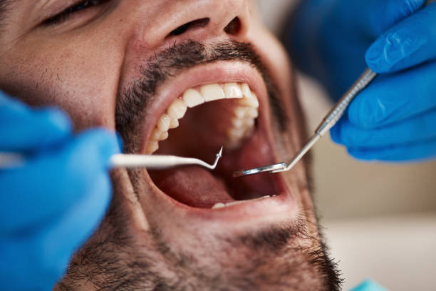 Best Emergency Broken Tooth Repair in Villa Park, CA